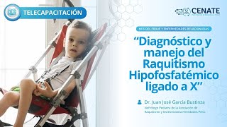 Diagnóstico y manejo del Raquitismo Hipofosfatémico ligado a X [upl. by Sahc320]