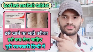 Lorfast meltab tablet use dose benefits and side effects full review in hindi loratadine [upl. by Llerrat]