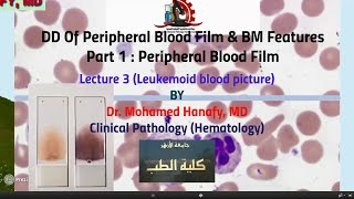 Part1  Peripheral Blood Film Lecture 3 Leukemoid blood picture [upl. by Eniad334]