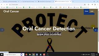 Oral Cancer Detection using Deep Learning  Python Final Year IEEE Project 2024 [upl. by Htebaras455]