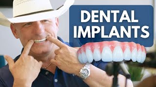 Why No One Tells You The Cost Of Dental Implants [upl. by Whittaker697]