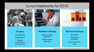 DCIS What You Need to Know [upl. by Adnilam]