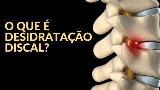 O que é Desidratação Discal [upl. by Eeladnerb]