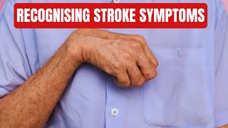 How To Tell If You Had A Stroke or TIA Minor Stroke  Stroke Symptoms amp Signs [upl. by Sassan]