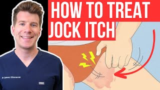 Doctor explains how to RECOGNISE AND TREAT JOCK ITCH aka Tinea Cruris or Ringworm of the groin [upl. by Dor]