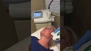 Rosacea Treatment with IPL [upl. by Hwu221]