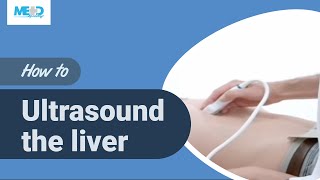 How to ultrasound the liver [upl. by Carolyne]