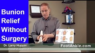 Dont Have Bunion Surgery Until You Watch This  Podiatrist Explains How to Avoid Bunion Surgery [upl. by Nnylimaj658]