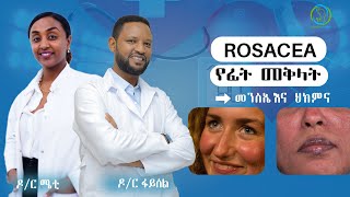 Rosacea የፊት መቅላትመንስኤ ና ህክምና  Dr Feysel Alo [upl. by Leibarg]