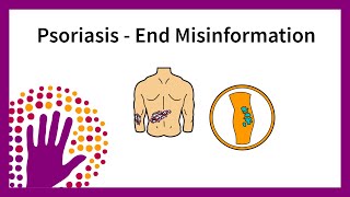 Psoriasis  End misinformation [upl. by Cirone]