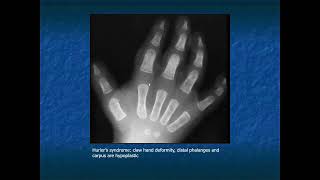 RADIOLOGY EXAM CASES [upl. by Seabrook]