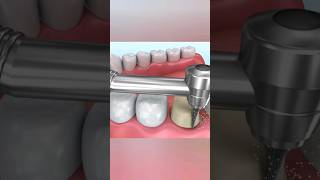 dental teeth animation viral shorts health motivation 3d fitness gym 3danimation anatomy [upl. by Ardnaiek571]