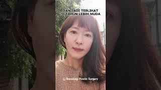 Jadi lebih muda 10 tahun dengan face lifting dan upper blepharoplasty di BANOBAGI [upl. by Nitsud]