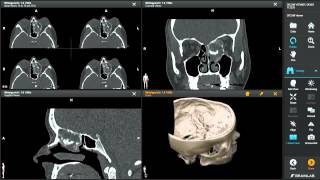 DICOM Viewer—Medical Image Manipulation [upl. by Ahtelat417]