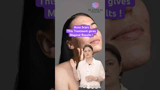 How to Get Rid of Stubborn Acne Scars  Acne Scars Treatment  Platinum Skin Laser  Phagwara [upl. by Adnak]