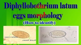 Diphyllobothrium latum eggs morphology How to identify [upl. by Quar707]