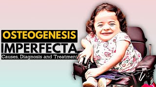 OSTEOGENESIS IMPERFECTA OI Causes Signs and Symptoms Diagnosis and Treatment [upl. by Brady97]