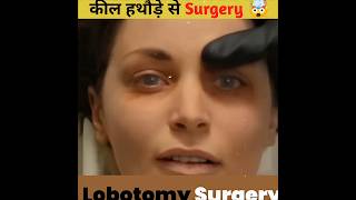 Lobotomy Surgery A Dark History 🥵shorts [upl. by Duvall]