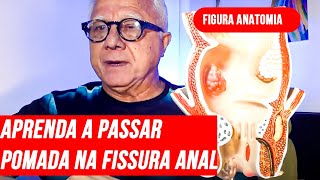 FissuraAprendam passar pomada manipulação fissura anal certa no local certo e seu efeito colateral [upl. by Nnanerak]