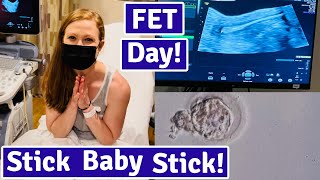 Frozen Embryo Transfer Day FET Process [upl. by Jennee]