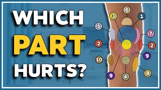 My knee hurts here 10 typical pain spots and what they mean [upl. by Arreit731]