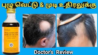 puluvettu in hair treatment in tamil kottakkal malatyadi kera thailam uses benefits alopecia areata [upl. by Lacim]