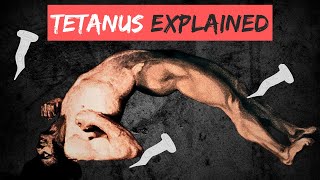 TETANUS explained in 10 Minutes [upl. by Andeee145]