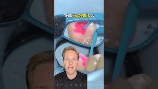 Why Your Dentist Uses This Pink Stuff To Find Hidden Cavities dental dentistry shorts [upl. by Iruam254]