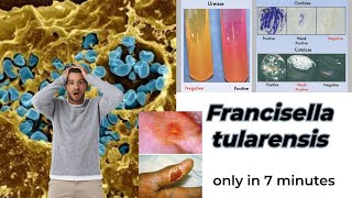 Francisella microbiology lecture  Francisella tularensis Easy Microbiology [upl. by Luhem986]