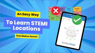 An Easy Way to Memorize STEMI Locations and Leads [upl. by Pavia]