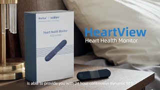 Viatom HeartView——Medical Grade AI Analysis Solution for Heart Disease Diagnosis [upl. by Lilahk]