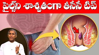 Piles Control Tips In Telugu  పైల్స్ ని శాశ్వతంగా తీసేసే టిప్  Dr Manthena Satyanarayana Raju [upl. by Harcourt914]