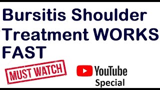 Bursitis Shoulder Treatment at Home  Help for Frozen Shoulder [upl. by Sweatt831]