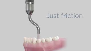 Acuris A Revolution in Dental Restoration Retention [upl. by Scarface]