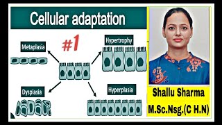 Cellular Adaptation TypesAtrophy HypertrophyPhysiological and pathological Atrophy [upl. by Yoshiko1]