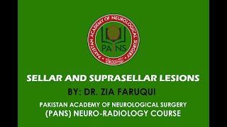 Sellar and Suprasellar Lesions by Dr Zia Faruqui  PANS [upl. by Melina]