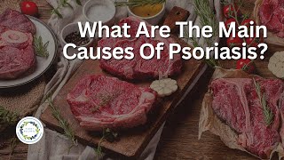 What Are The Main Causes Of Psoriasis [upl. by Joette762]