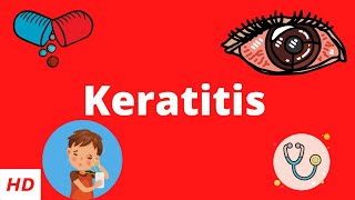 Keratitis Causes Signs and Symptoms Diagnosis and Treatment [upl. by Maghutte465]