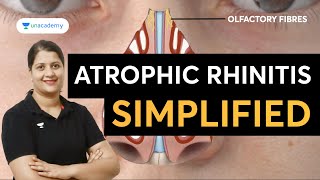 Atrophic Rhinitis Simplified  ENT with Dr Vyshnavi Jajee [upl. by Oys]