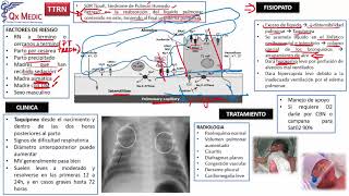 4 DIDICULTAD RESPIRATORIA TTRN [upl. by Garling]