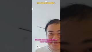 Scarra regrets streaming IRL with ExtraEmily 💀 [upl. by Herv]