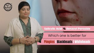 Salicylic Acid vs Benzoyl Peroxide  Get Rid of Pimples Blackheads amp Whiteheads  Dr Nivedita Dadu [upl. by Kcirdnekel]