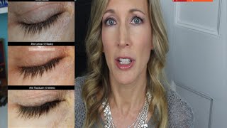 Grow Longer Lashes RapidLash Review  Latisse Comparison [upl. by Neerual]