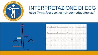 Interpretazione di ECG leggiamo insieme qualche elettrocardiogramma [upl. by Bihas529]