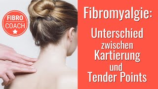 Fibromyalgie Was ist eine Kartierung und ist das was anderes als Tender Points [upl. by Trude]