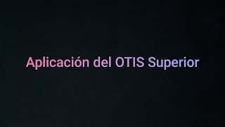 Simulación de aplicación del Test OTIS Superior [upl. by Monty]