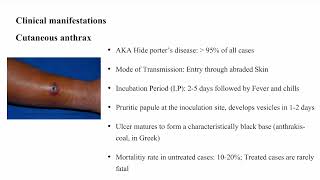 Anthrax Bacillus anthracis [upl. by Nerek]