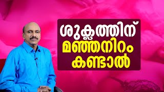 ശുക്ലത്തിന് മഞ്ഞനിറം കണ്ടാൽ  Yellow sperm can be caused by a variety of factors [upl. by Fortna]