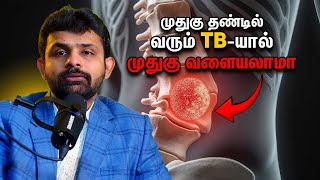 Can TB in the Spine Cause a Curve in Your Back Dr Vignesh Pushparaj [upl. by Attayek]