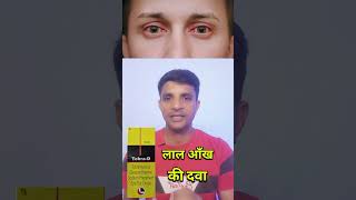 लाल आँख की दवा।। tobra d eye drop shorts short trending youtube [upl. by Server]